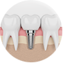 taylorsville implant center